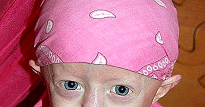¿Sabías Que La Enfermedad De La Progeria Puede Causar Que Los Jóvenes Crezcan?
