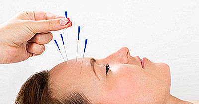 Die Ursprünge Der Akupunktur Verfolgen, Eine Praxis In Der Traditionellen Chinesischen Medizin