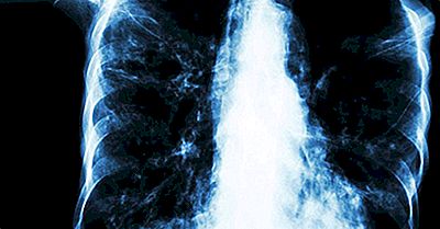 Die Am Wenigsten Von Tuberkulose Betroffenen Länder