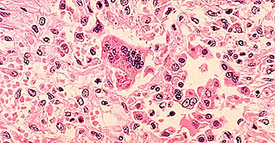 Vaccinazione Contro Il Morbillo In Tutto Il Mondo